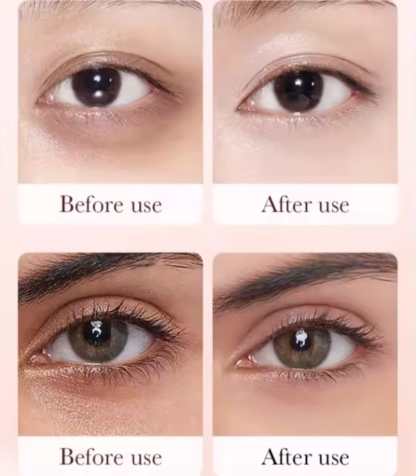 Retinol para contorno de olhos - Imagem 6