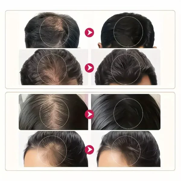 Biotin & Collagen hair oil - Imagem 3