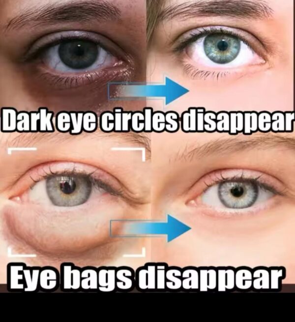 Collagen for eyes SADOER - Imagem 4