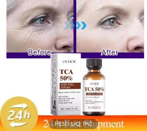 Skin peel serum TCA 50% - Imagem 2